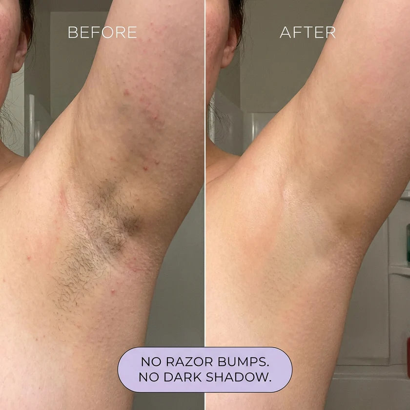 Nūda™ Pain-Free Hair Removal Spray