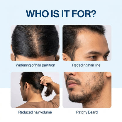 Advanced Hair Growth Roll‑On Serum for Men