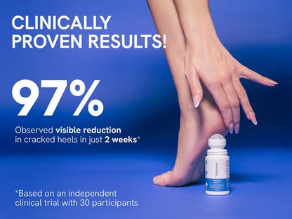 Urea Foot Roll On - 50 ml