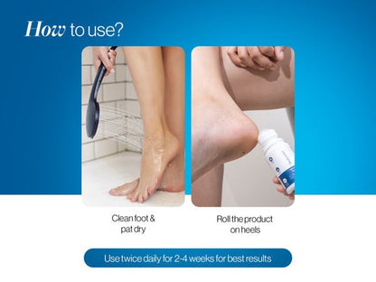 Urea Foot Roll On - 50 ml